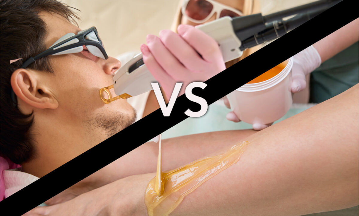 Traditional Methods of Hair Removal vs. Laser Hair Removal