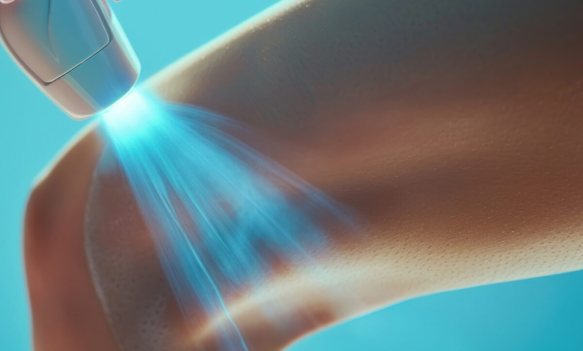 Is Laser Hair Removal Safe?