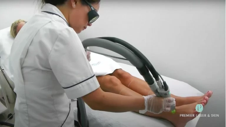 laser hair removal treatment on woman'e leg