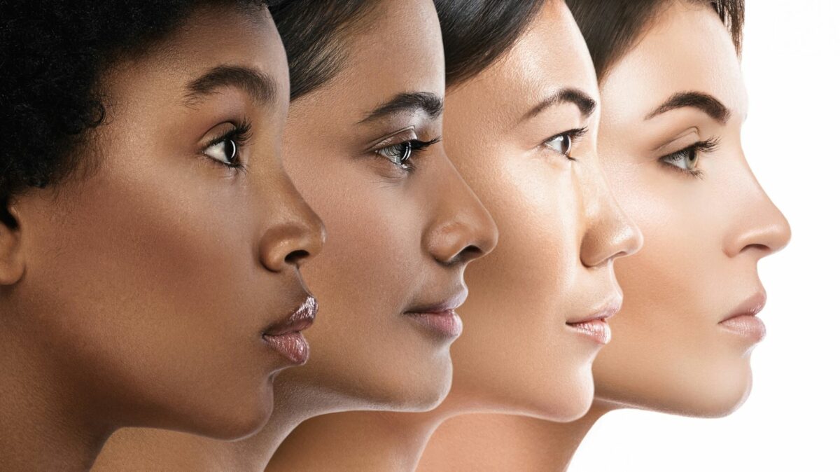 laser hair removal for dark skin
