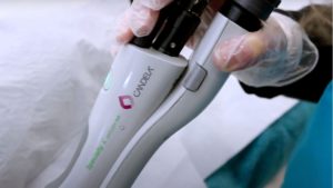 laser hair removal croydon