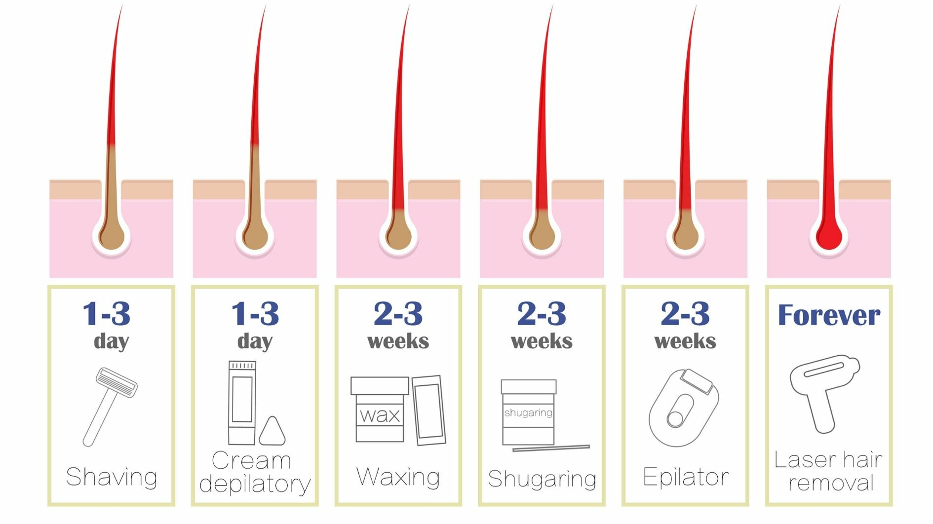 laser hair remvoal v epilation