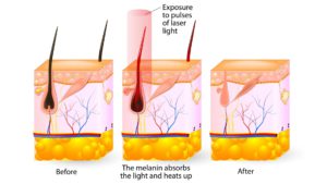 hair growth cycle