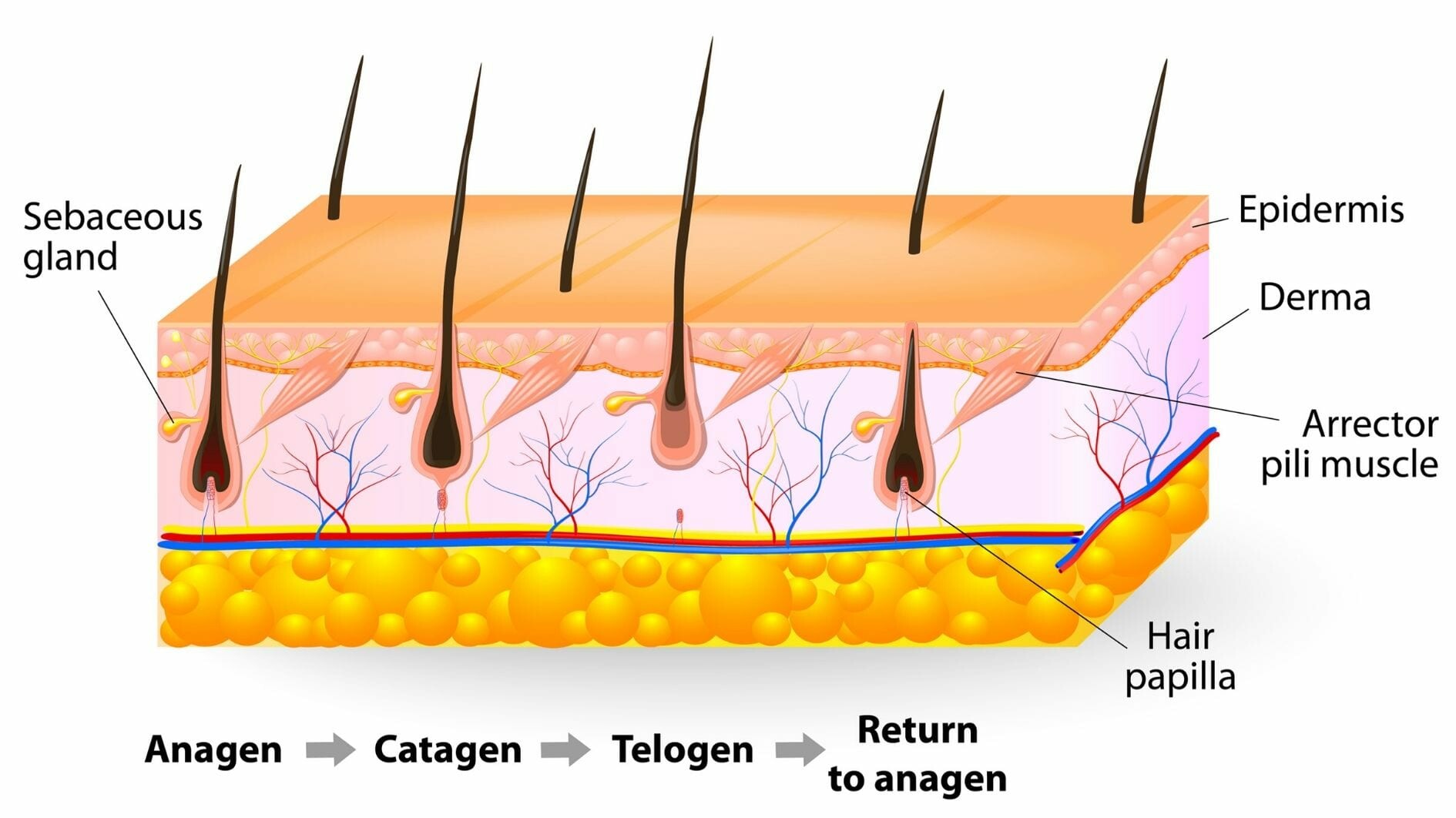 laser hair removal
