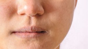hydrafacial dry skin