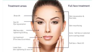 hifu facial treatment pros and cons