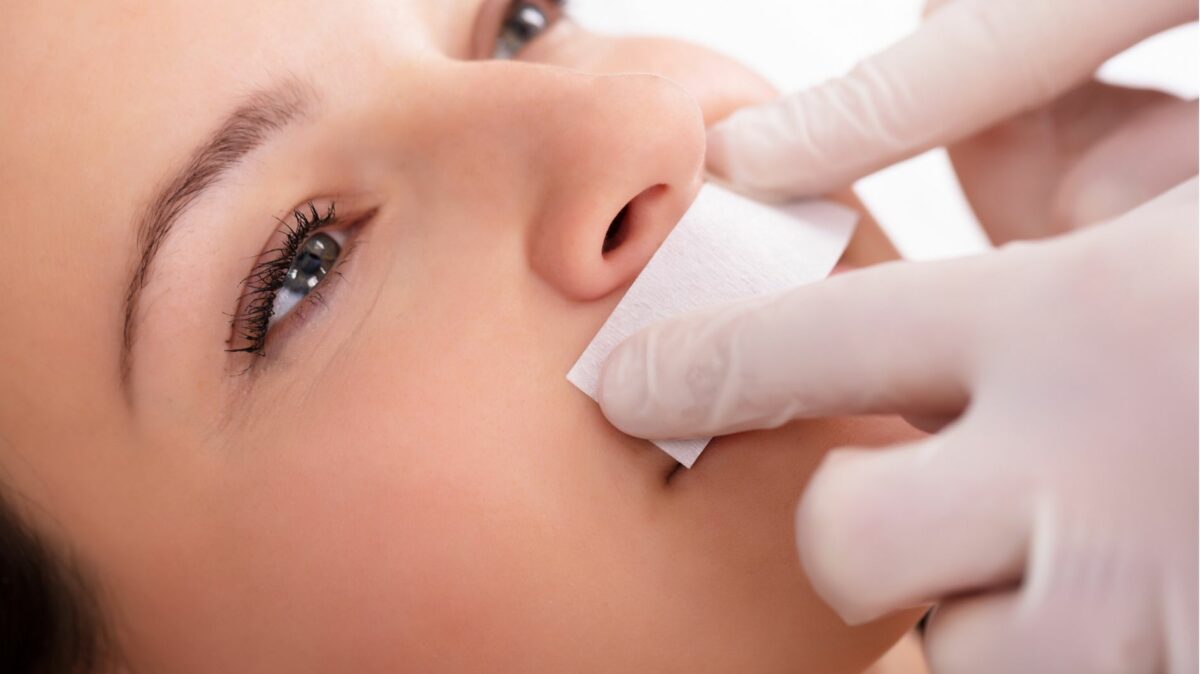 facial laser hair removal model