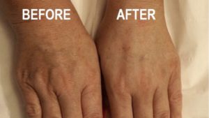 handcare coronavirus gloves