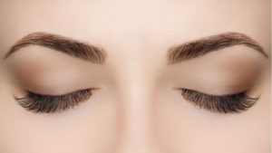 laser hair removal