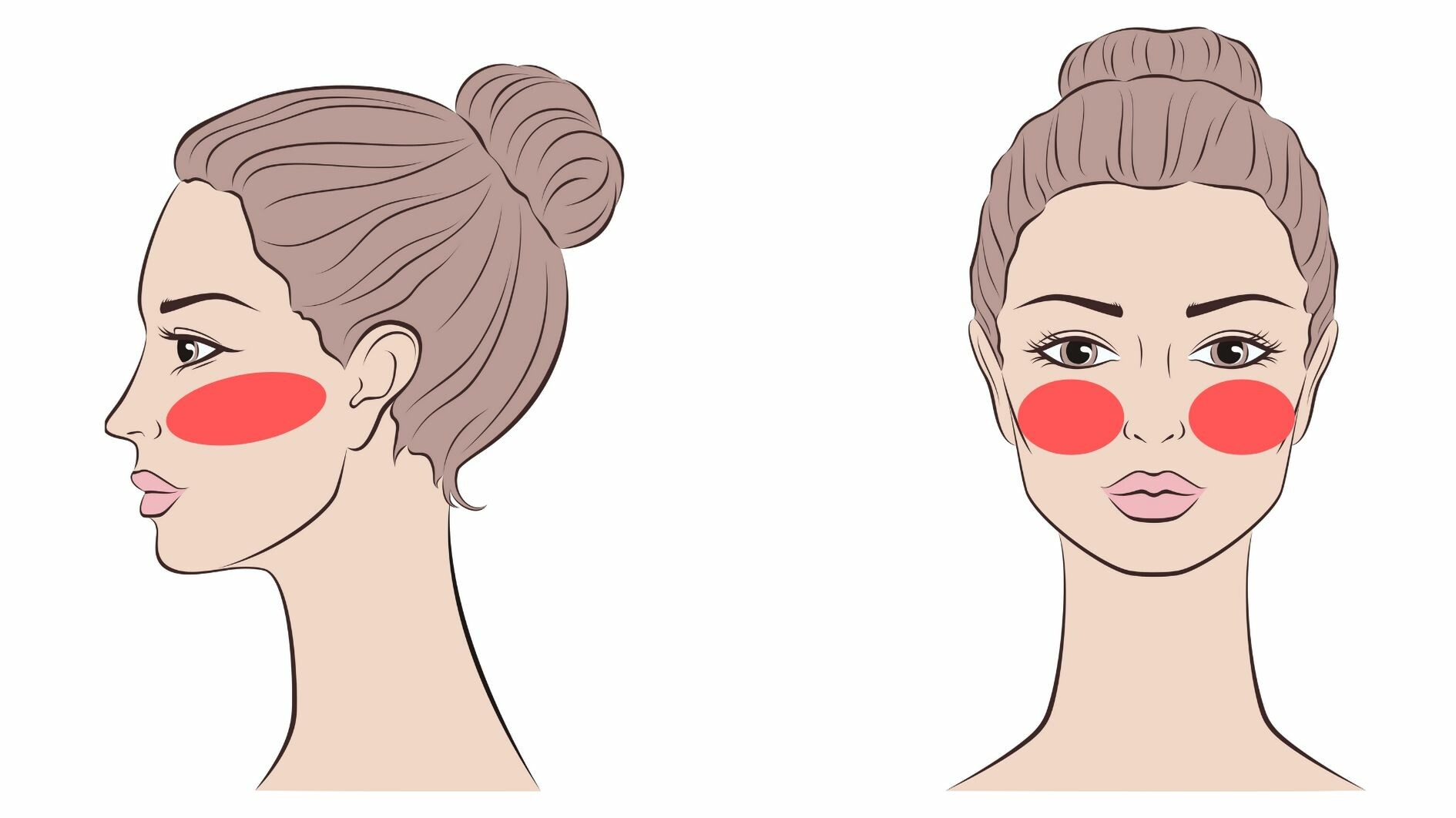 facial laser hair removal cheeks treatment area