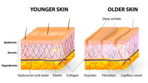 hydrafacial or chemical peel
