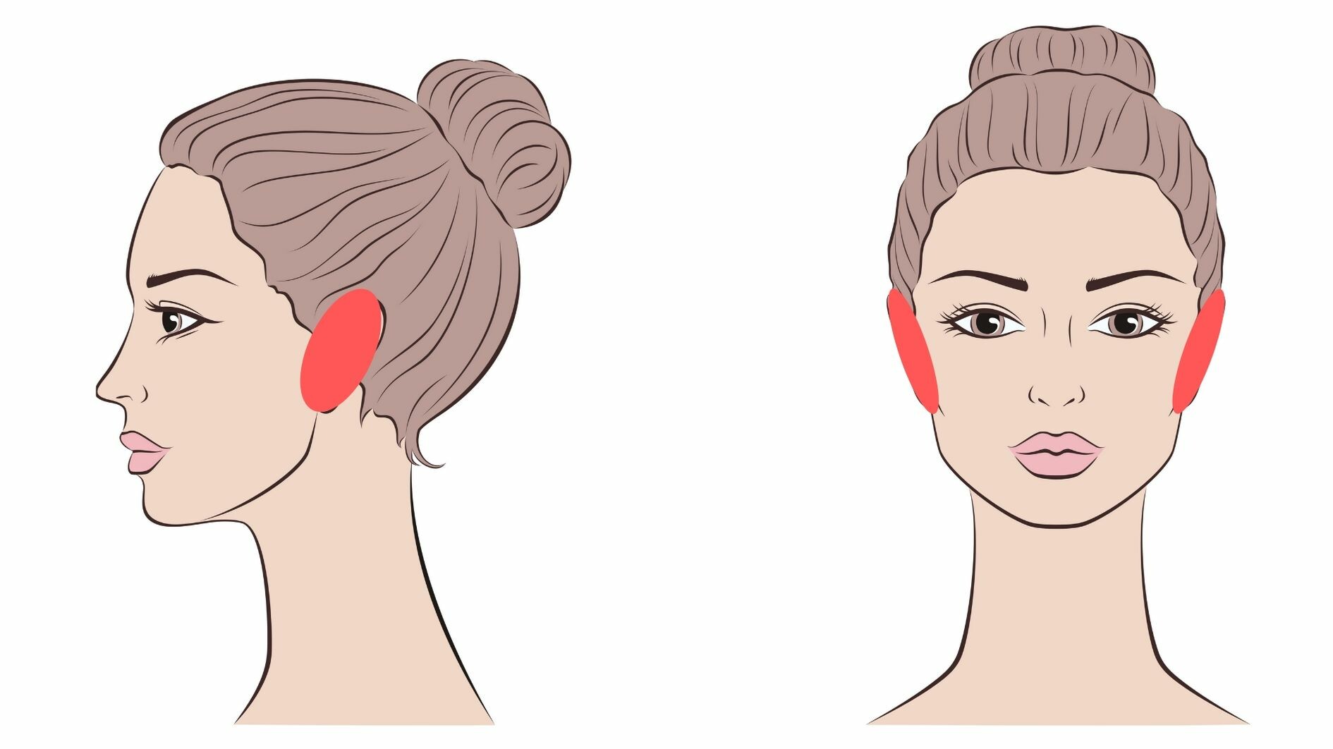 facial laser hair removal earsl treatment area