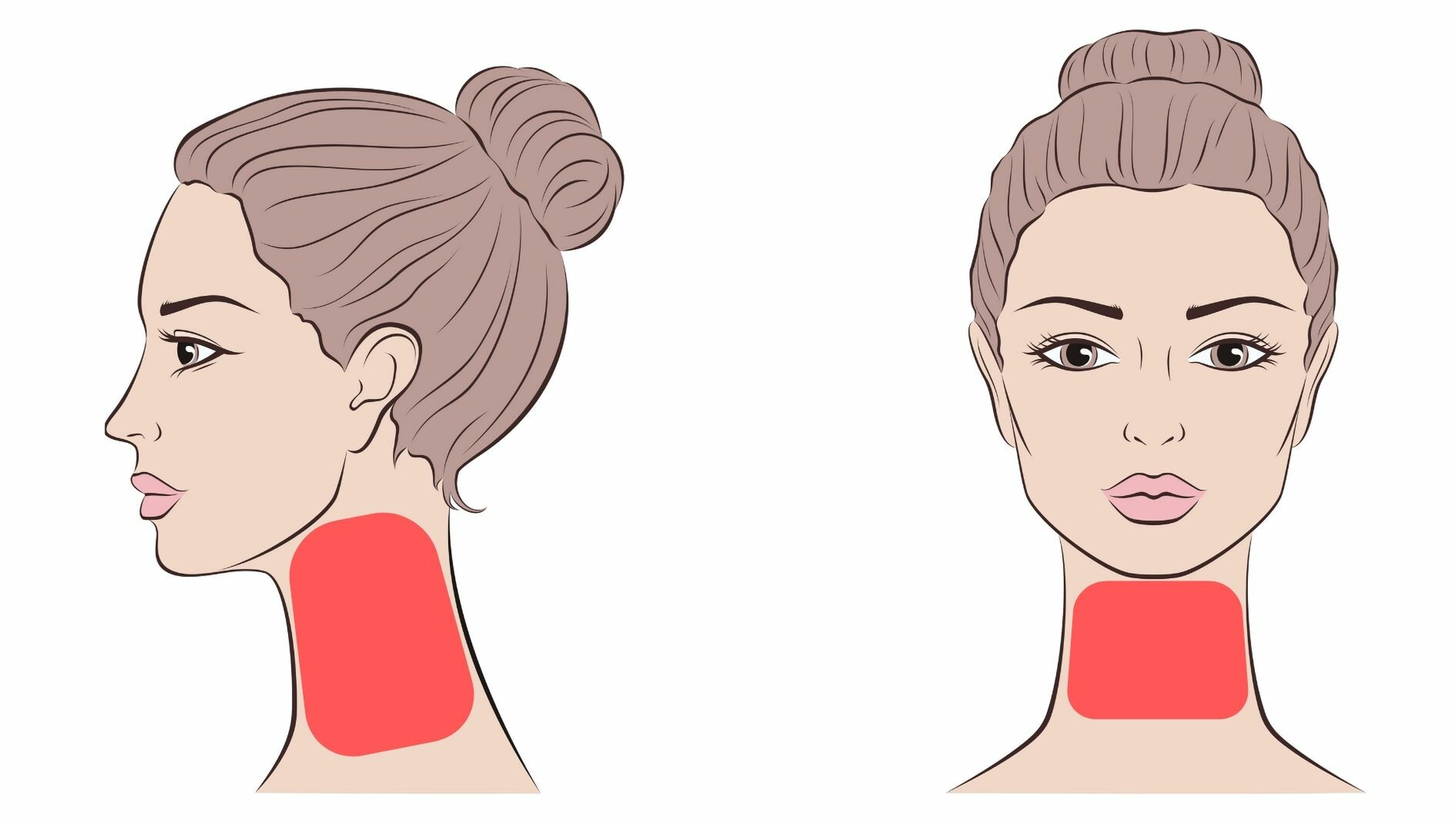 facial laser hair removal neck treatment area