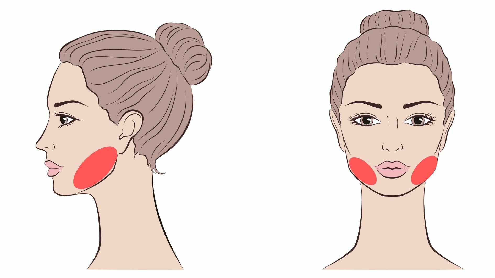 facial laser hair removal jawline treatment area
