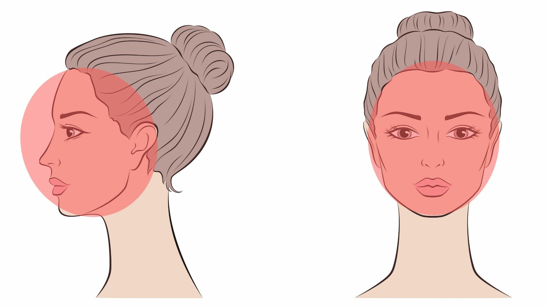 facial laser hair removal full face treatment area