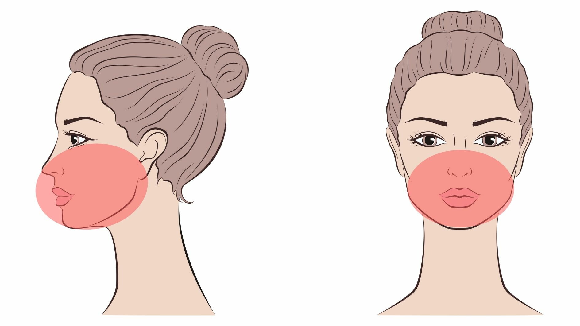 facial laser hair removal half face treatment area
