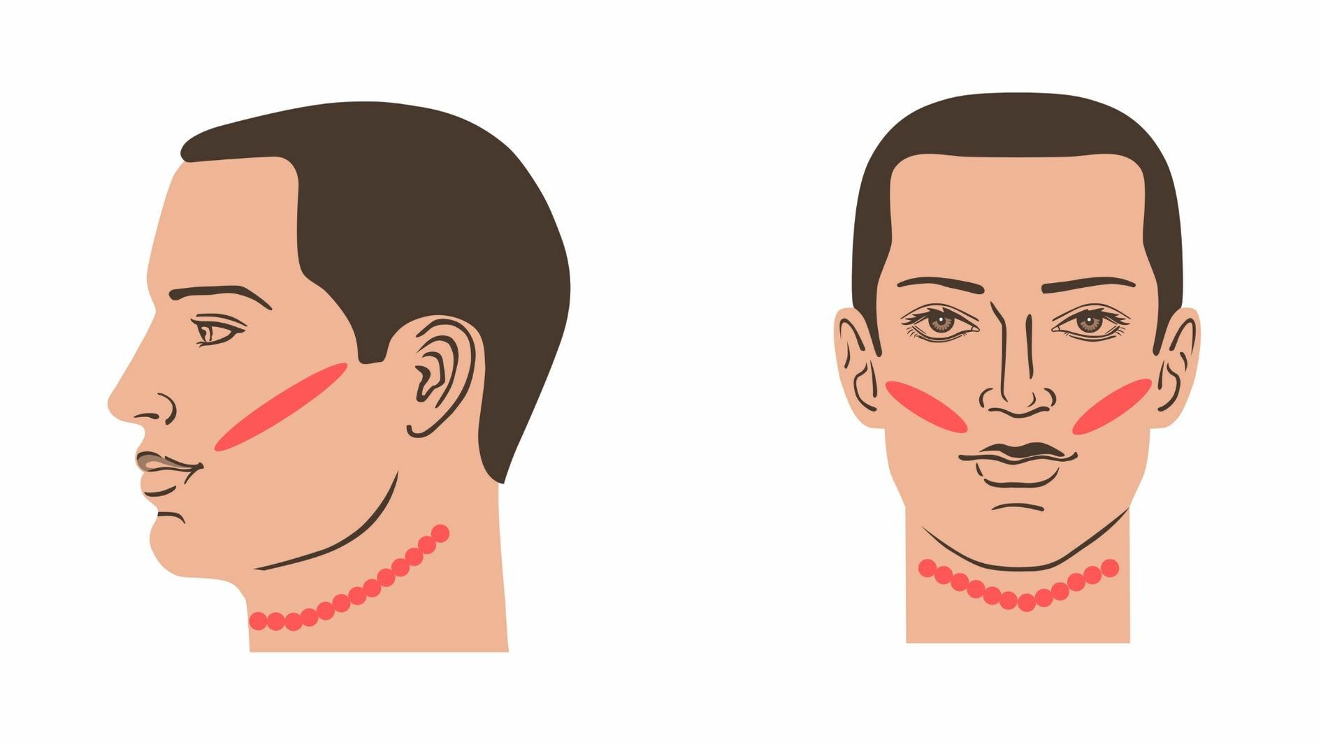 facial laser hair removal beard line for men treatment area