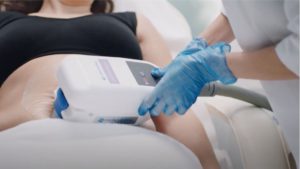 coolsculpting London
