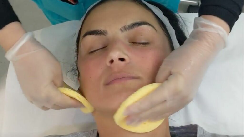 dermapen