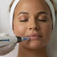 Dermapen Microneedling