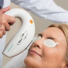 IPL Skin Rejuvenation