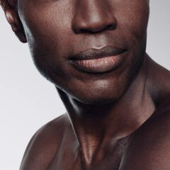 Laser Hair Removal for Dark Skin