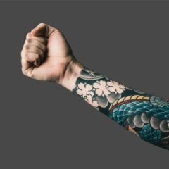 Laser Tattoo Removal