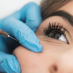 Supermodel Cheek Lift