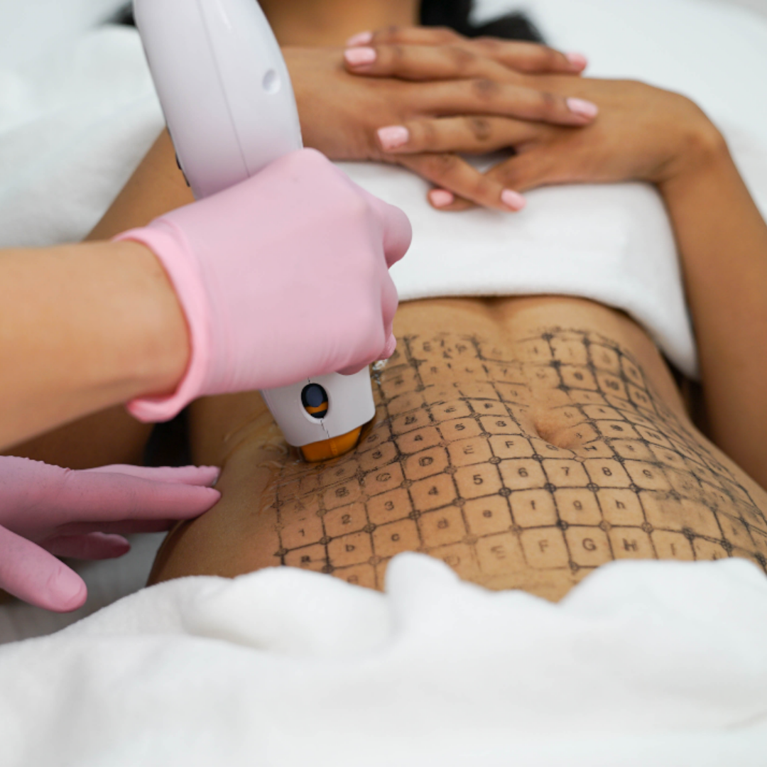 What causes loose skin after you lose weight?