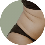 Remove unwanted fat, sculpt my body