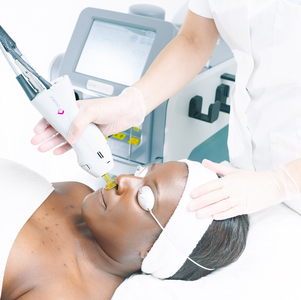 will laser hair removal work Permanently?