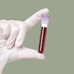 blood test London