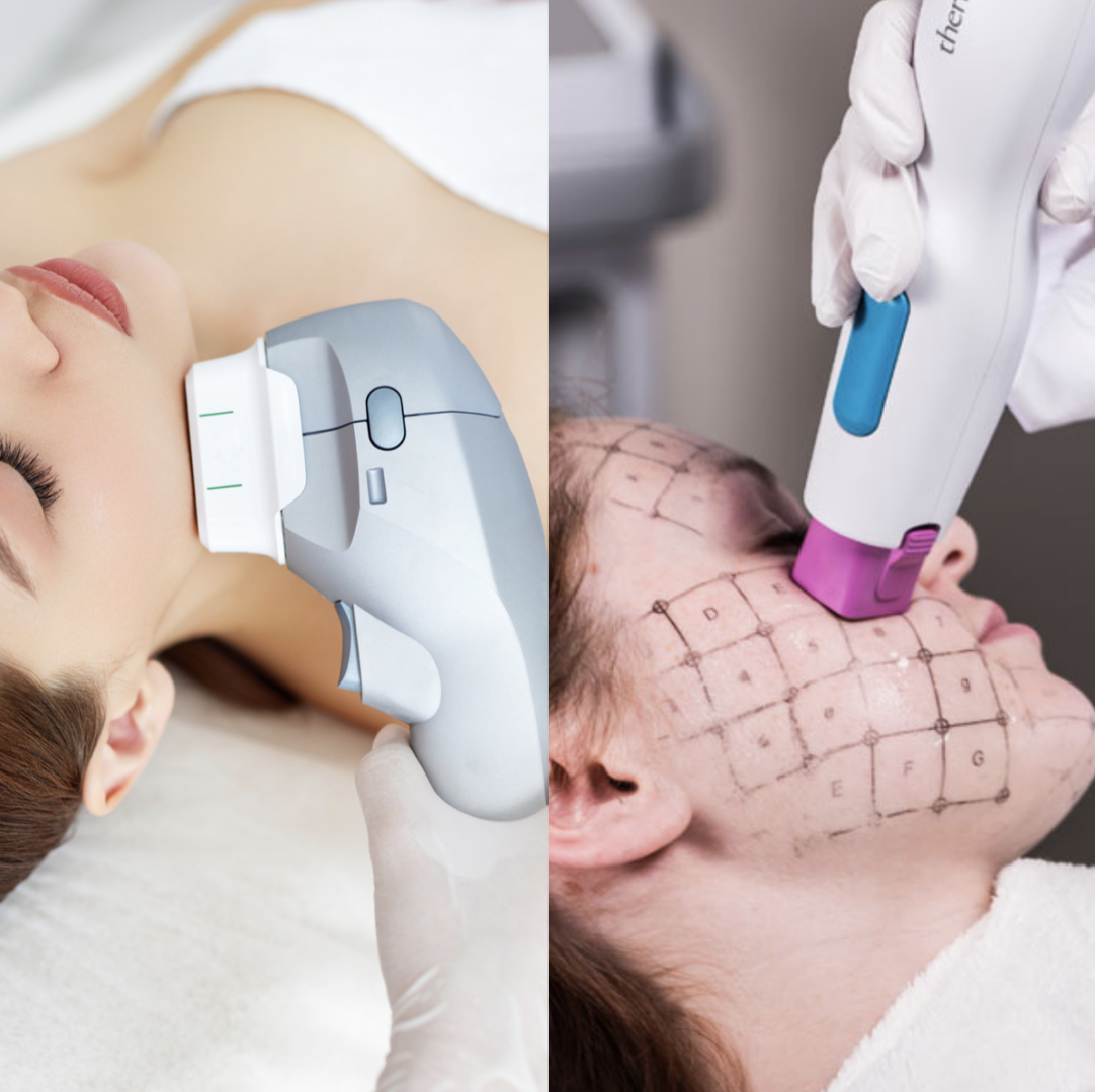 HIFU OR THERMAGE?
