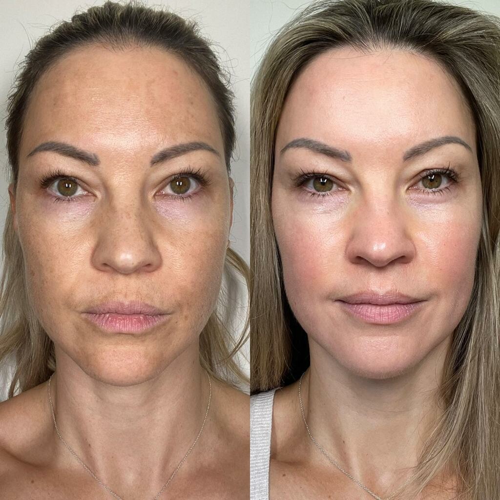 BEFORE & AFTER GALLERY