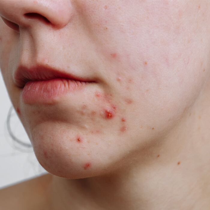 Treatment photo