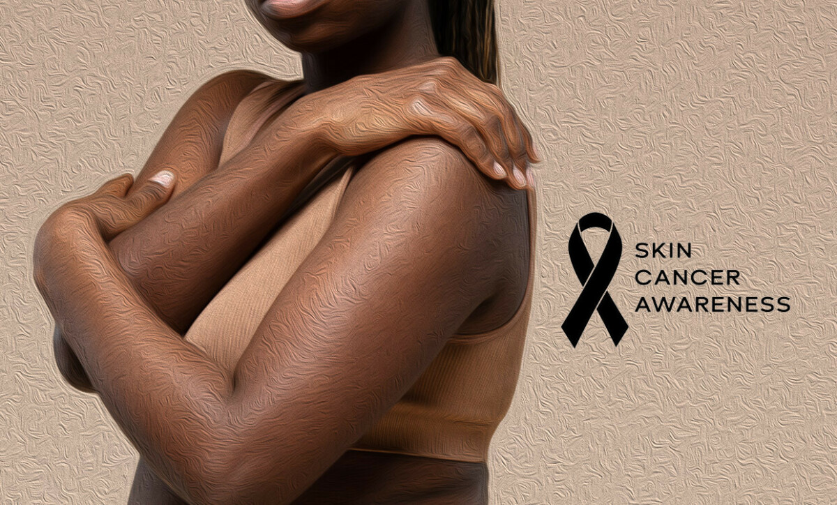 Skin Cancer Symptoms in Darker Skin Tones