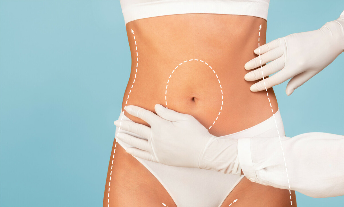 choosing the right body contouring treatment