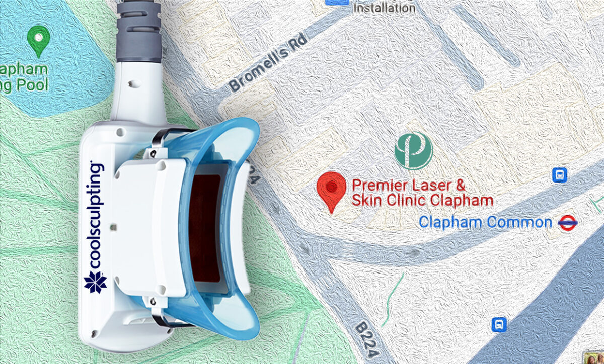 Coolsculpting availalbe in Clapham