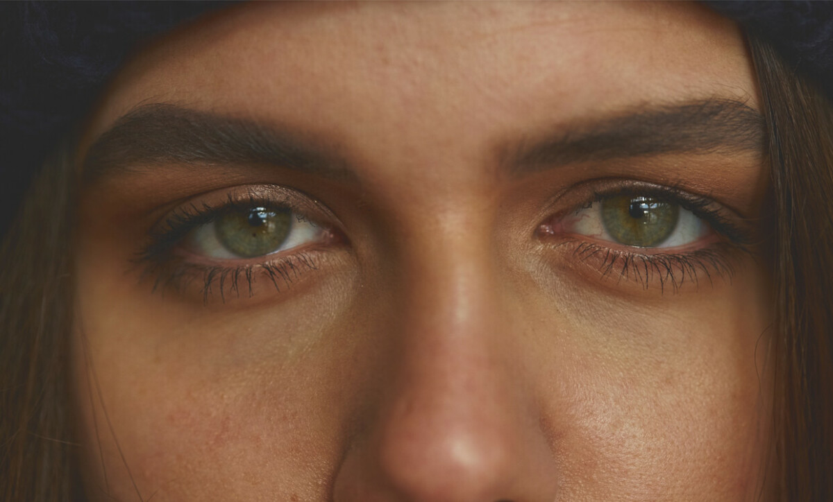 Why Do I Have Dark Circles Under My Eyes?