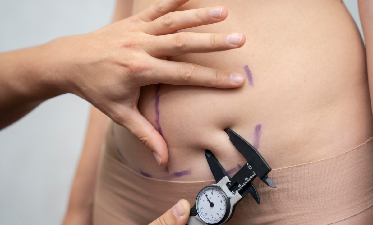 Fat Freezing Results