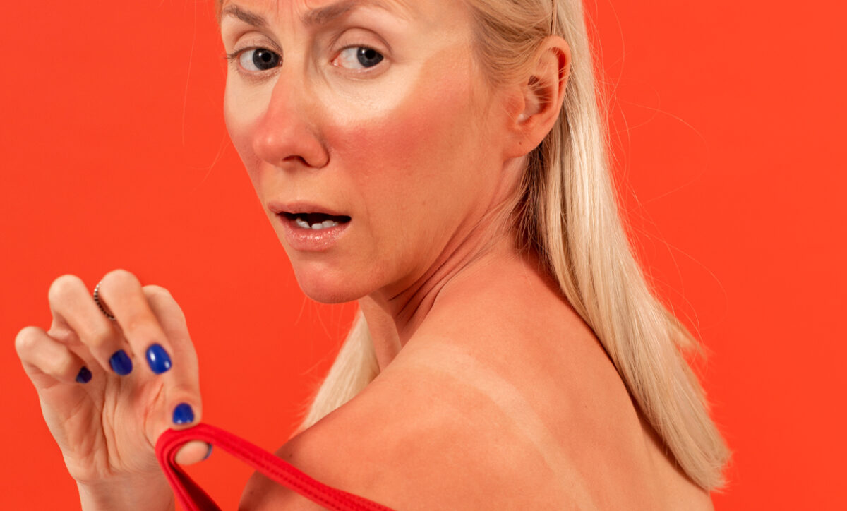 Best treatments for sun damage