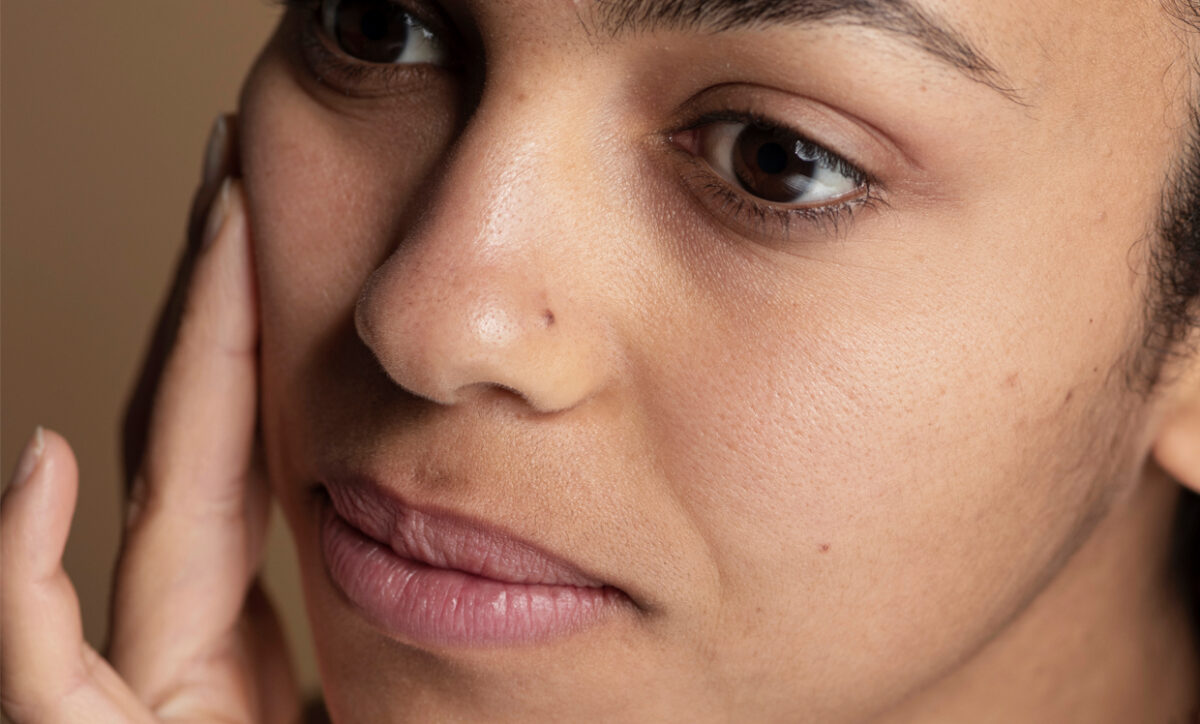 Can Laser Hair Removal Worsen Hyperpigmentation?