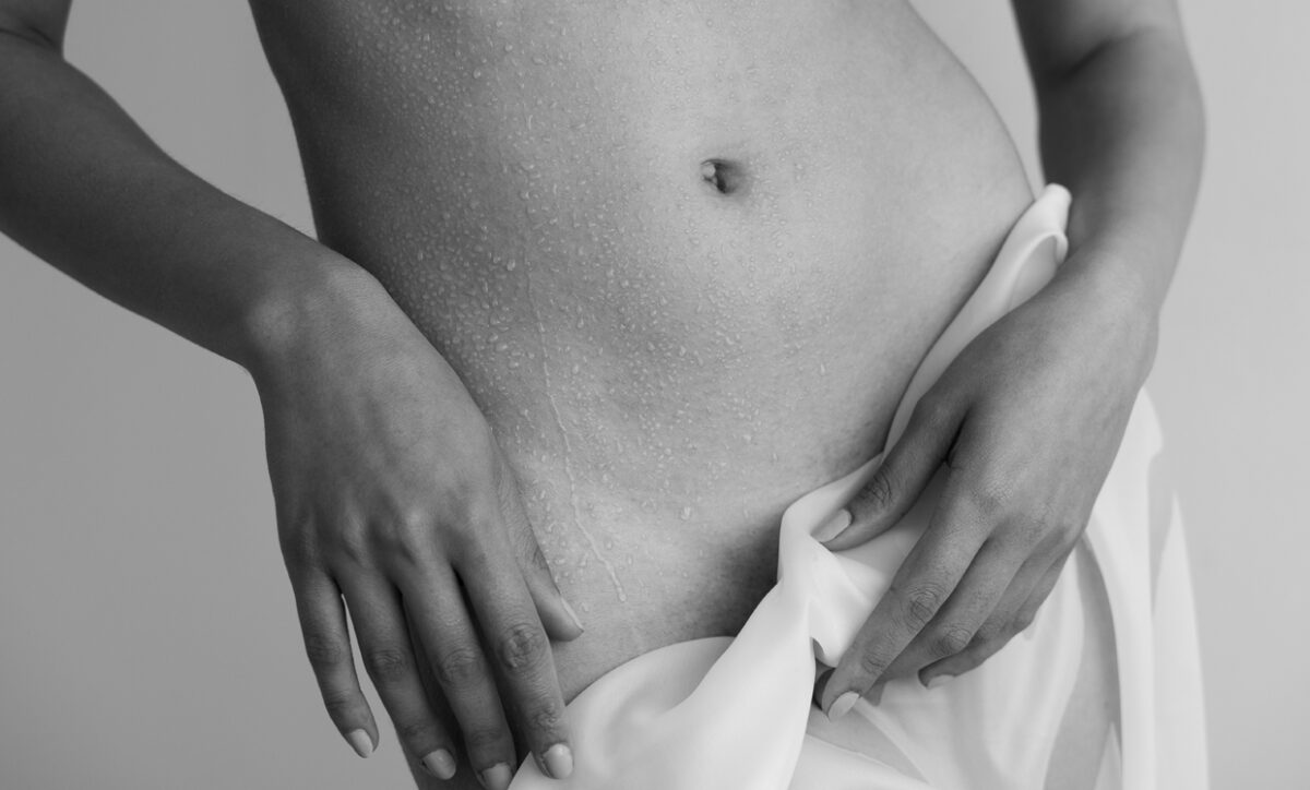 Is it Normal for Pubic Hair to Fall Out After Laser?