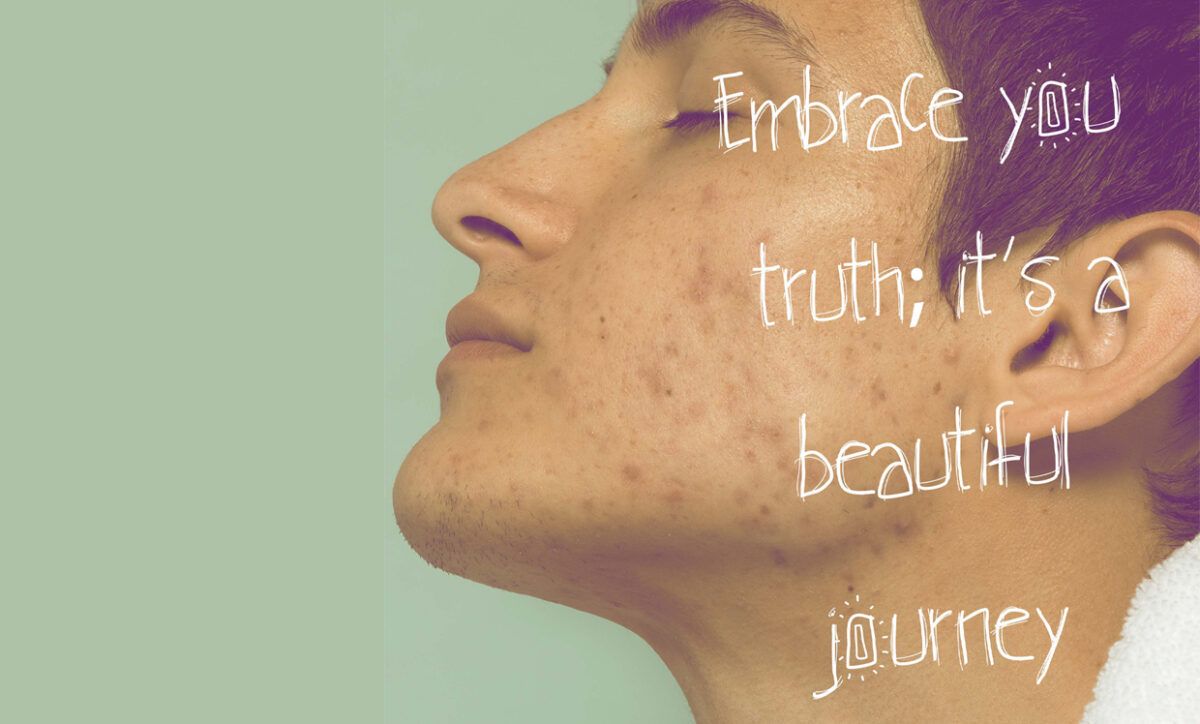 How Skin Concerns Affect Mental Health