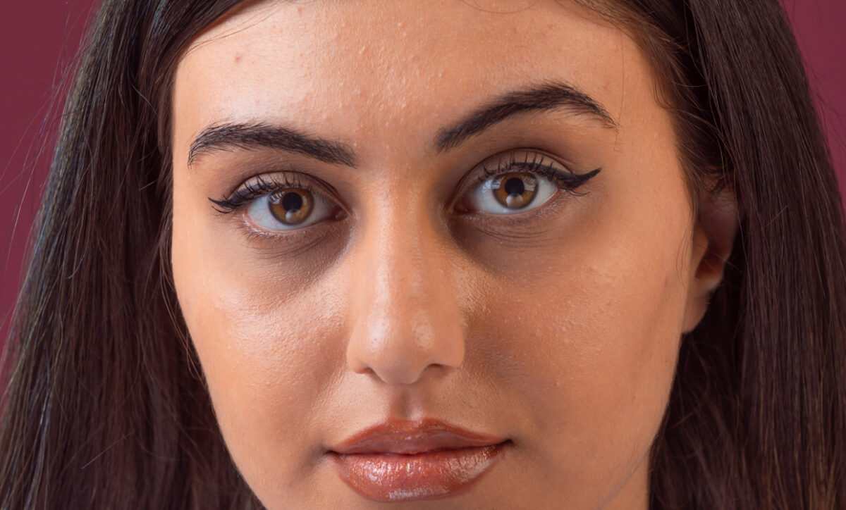 How Long Treatment For Dark Circles Under Eyes Lasts?