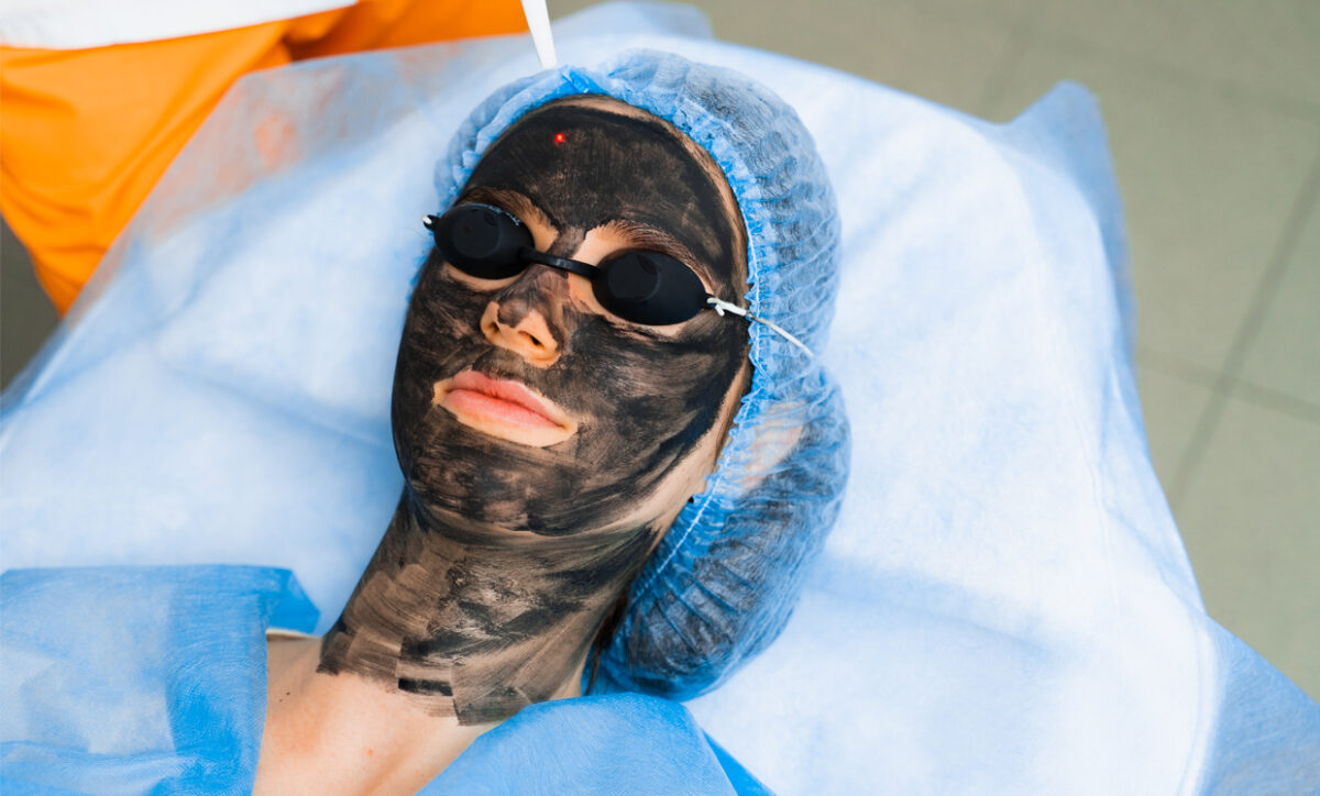 What Not to Do Before a Carbon Laser Facial