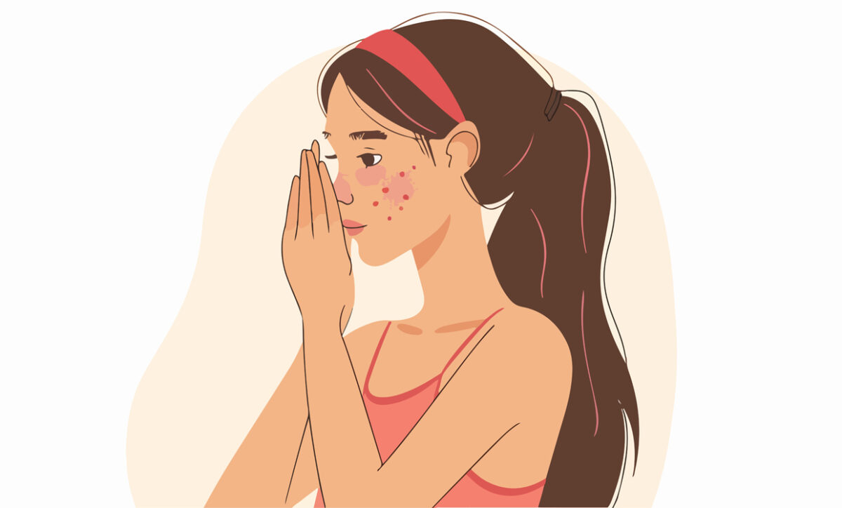 Why Did I Suddenly Develop Rosacea?