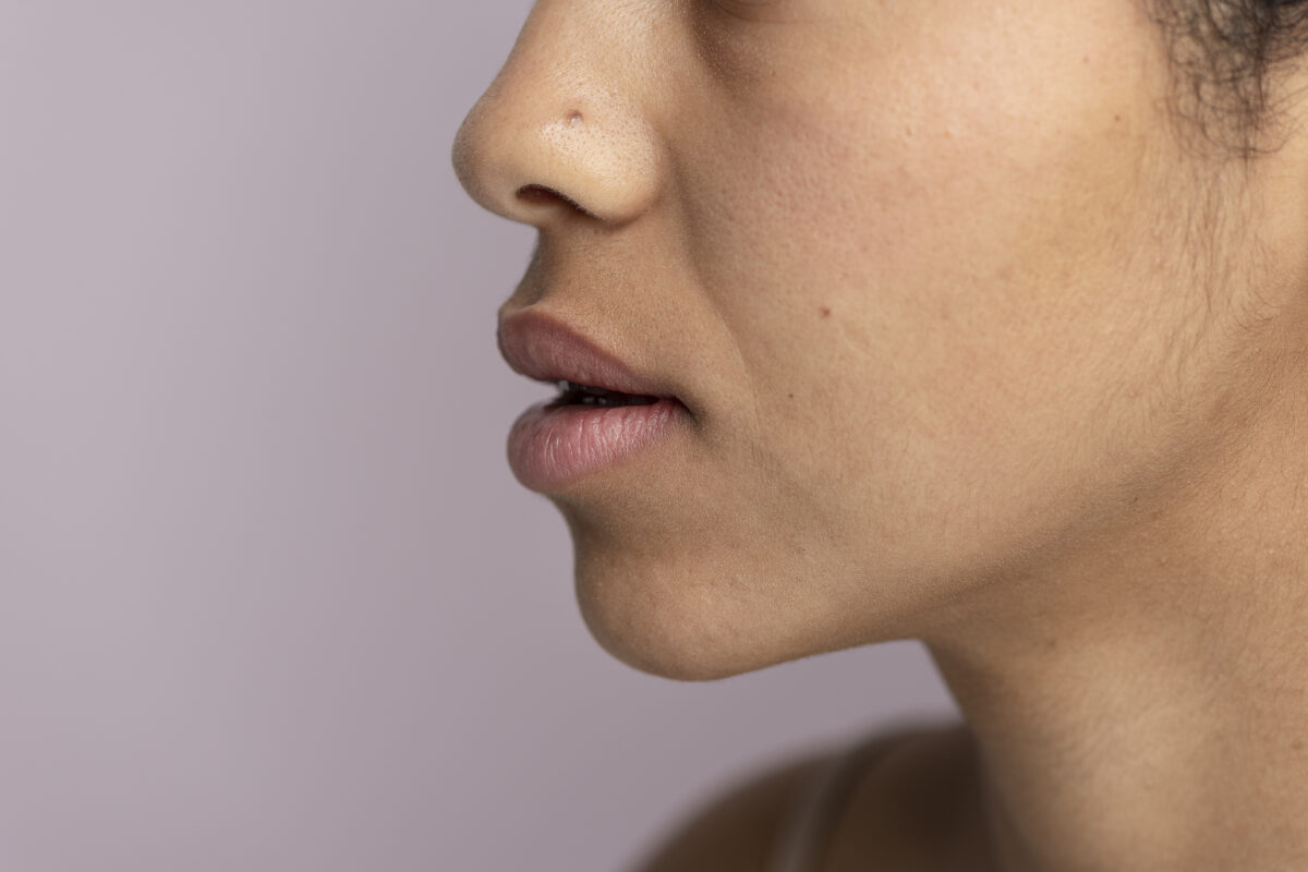 Can You Reverse Facial Hair Growth?