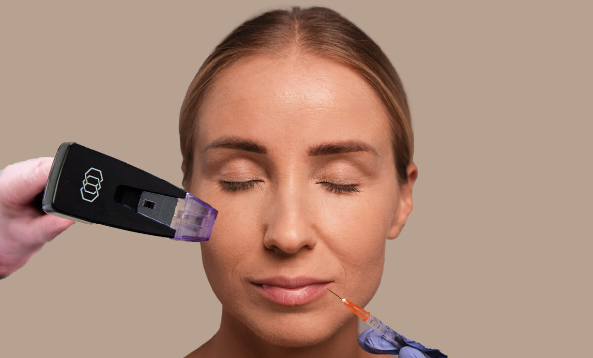 Is Morpheus8 Better Than Fillers?