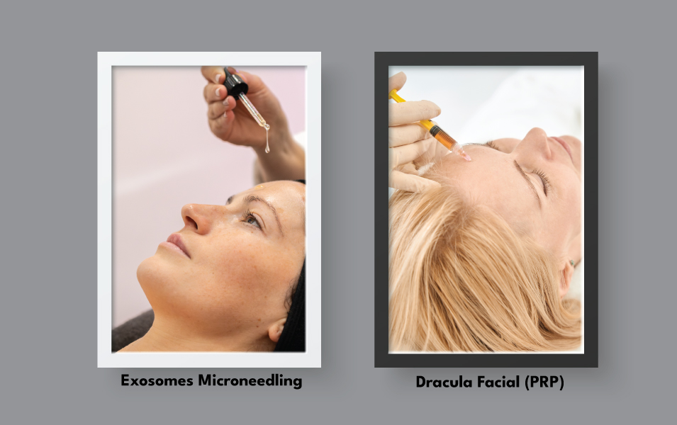 Which-is-Better-Dracula-Facial-or-Exosomes
